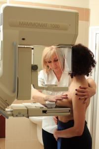 Zapraszamy na kolejne badania mammograficzne